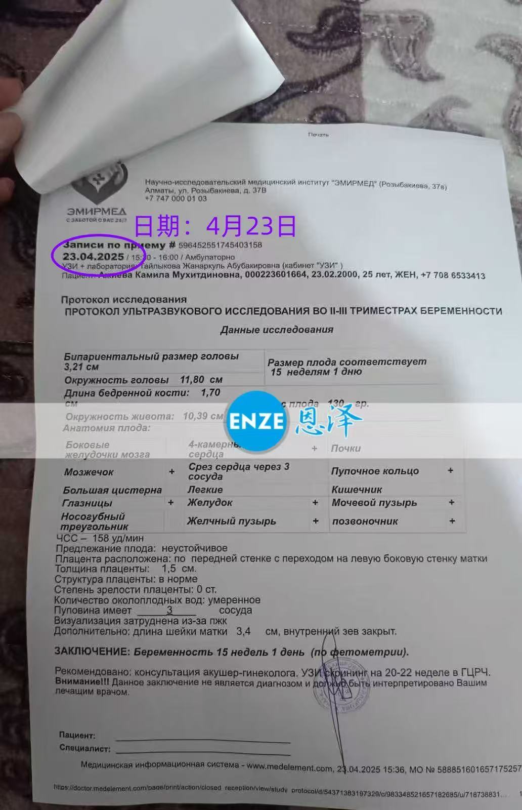格鲁吉亚试管婴儿助孕爱心使者15周产检顺利通过