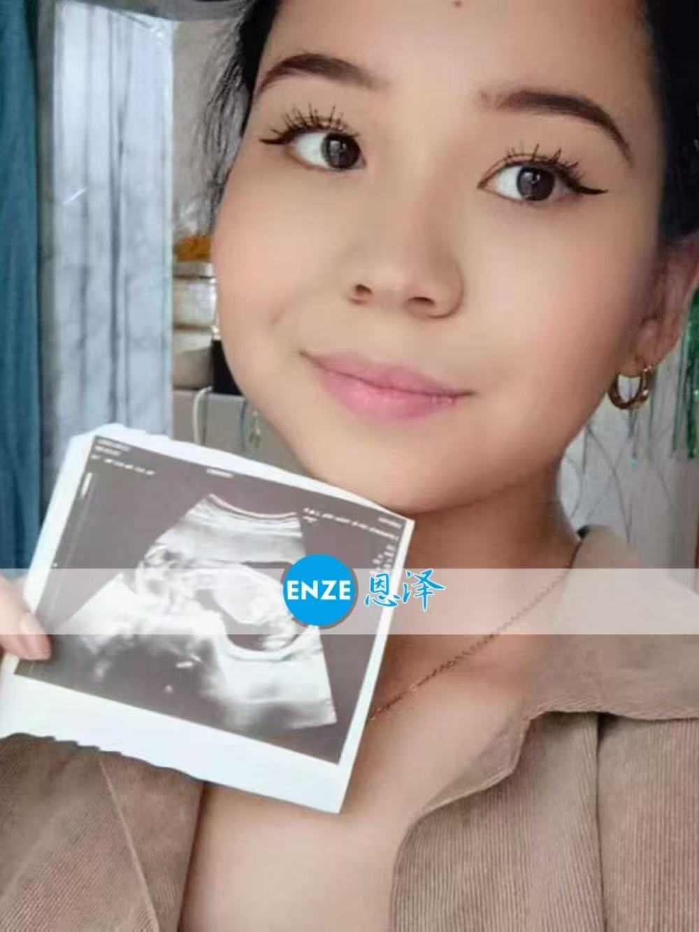 格鲁吉亚试管婴儿助孕爱心使者15周产检顺利通过