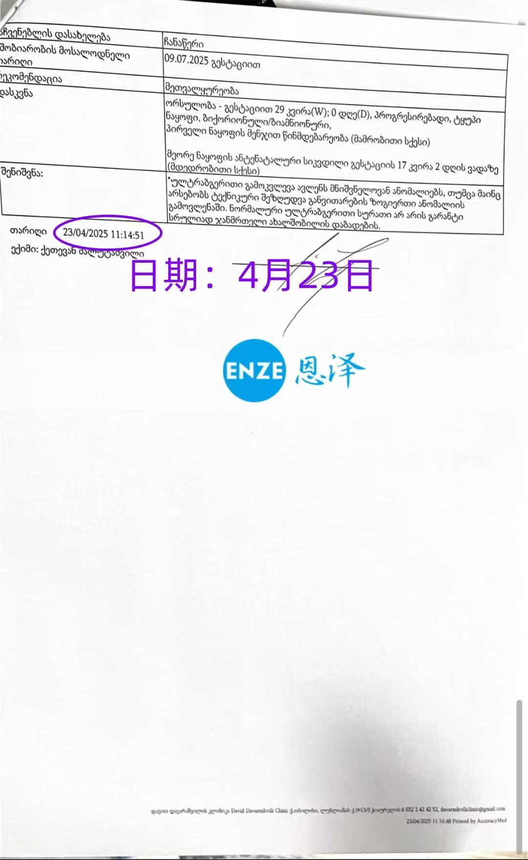 格鲁吉亚试管婴儿助孕爱心使者29周产检顺利通过
