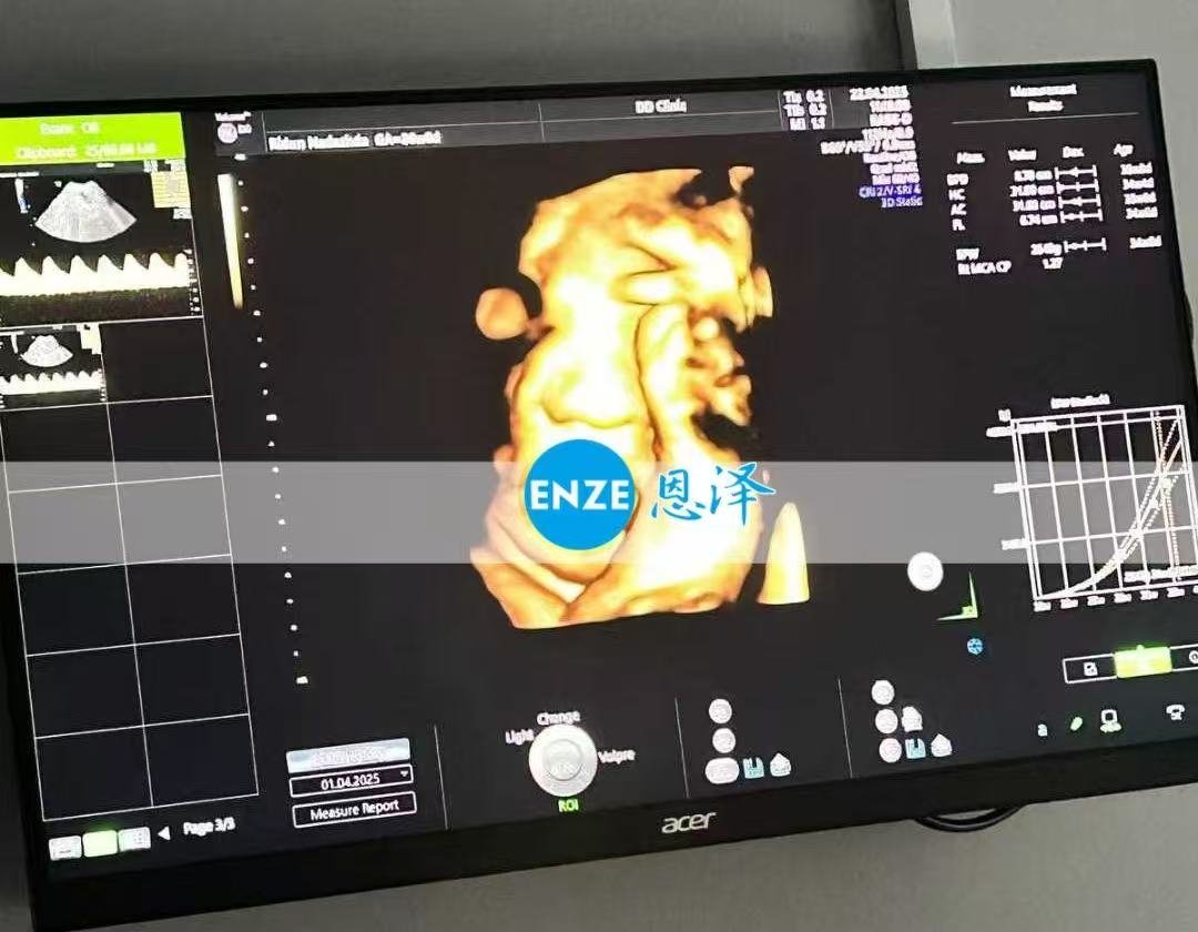 格鲁吉亚试管婴儿助孕爱心使者孕期开启倒计时