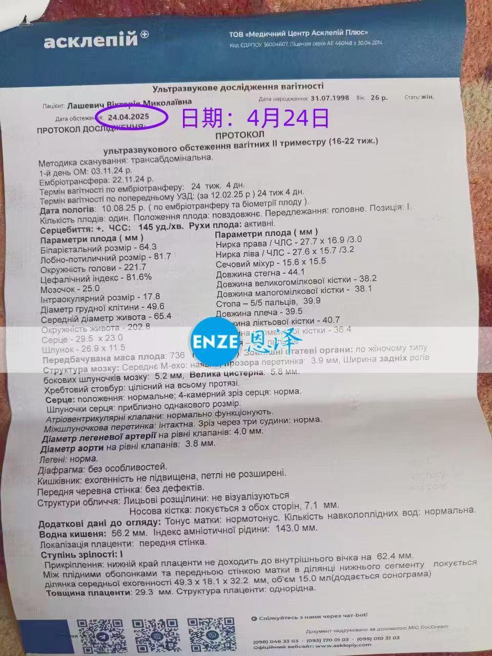 乌克兰试管婴儿助孕爱心使者20周产检顺利通过