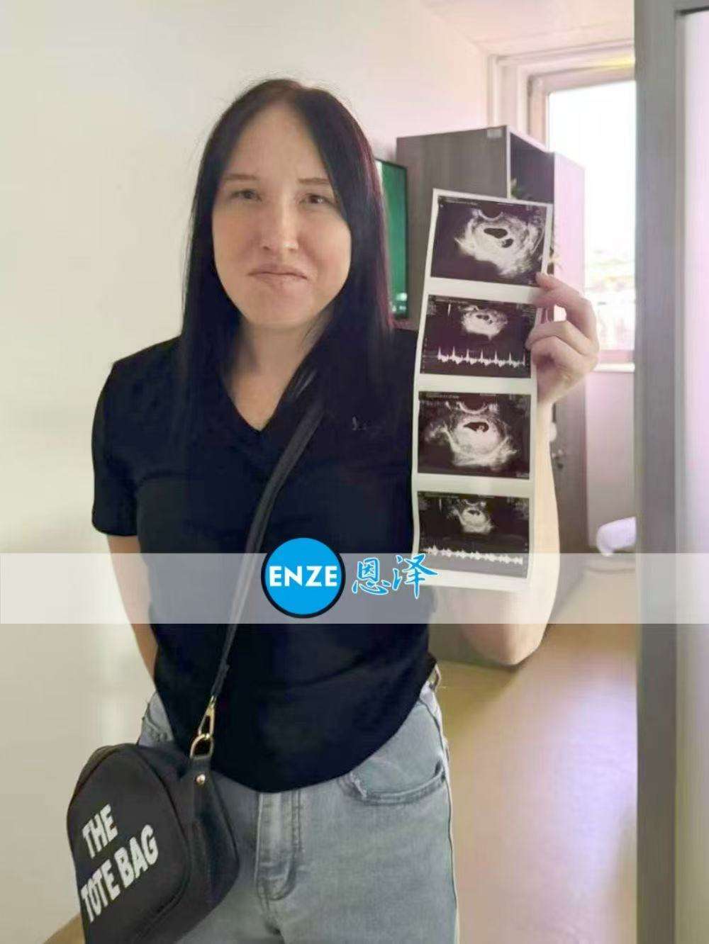 格鲁吉亚试管婴儿助孕爱心使者首检确认双胎报到