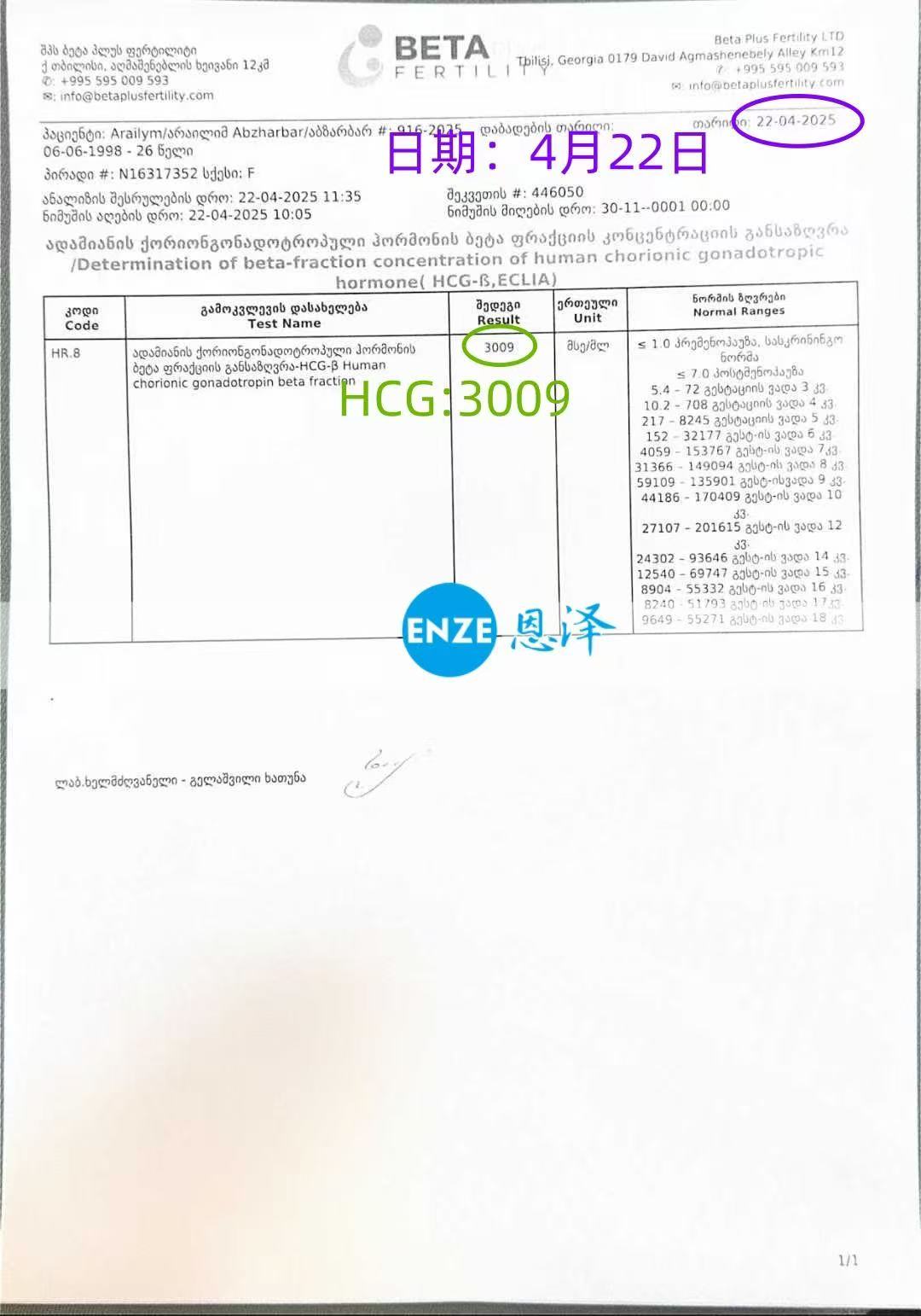 格鲁吉亚试管婴儿助孕爱心使者胚胎着床成功
