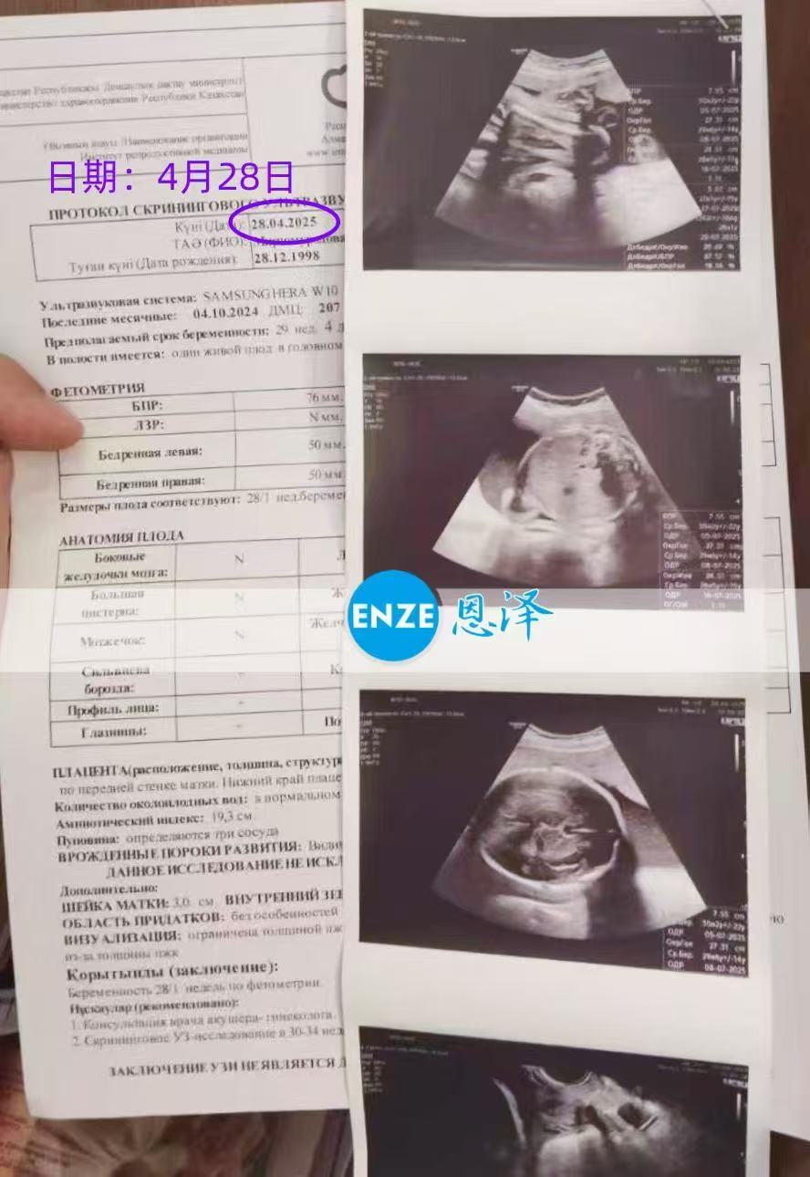 哈萨克斯坦试管婴儿助孕爱心使者成功通过29周产检