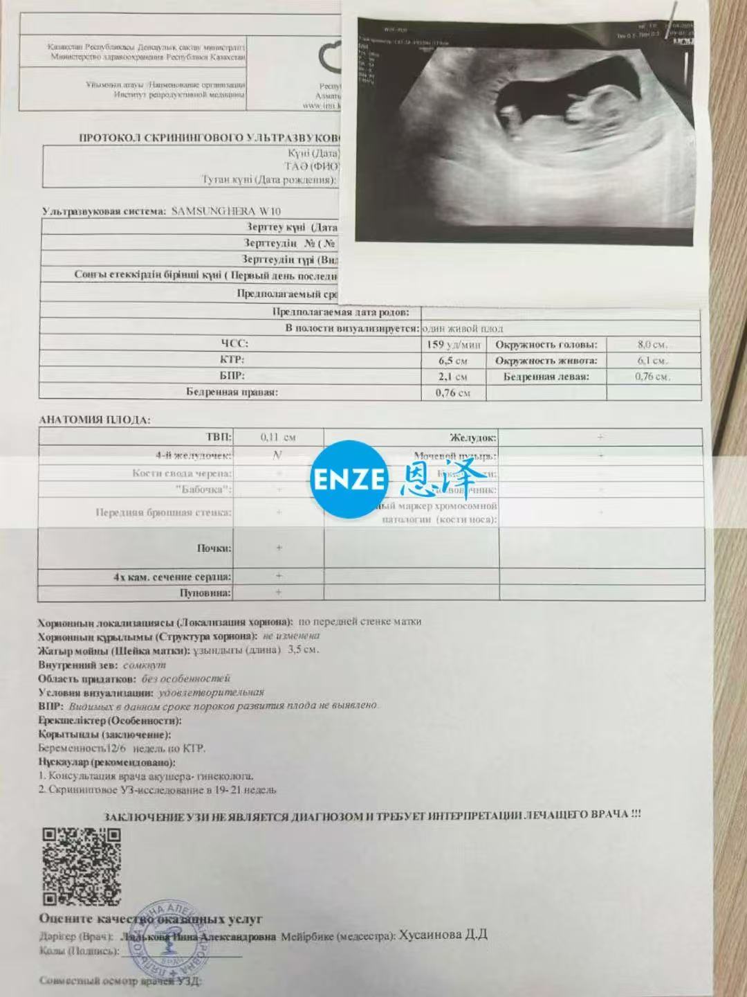 哈萨克斯坦试管婴儿助孕爱心使者12周产检顺利过关