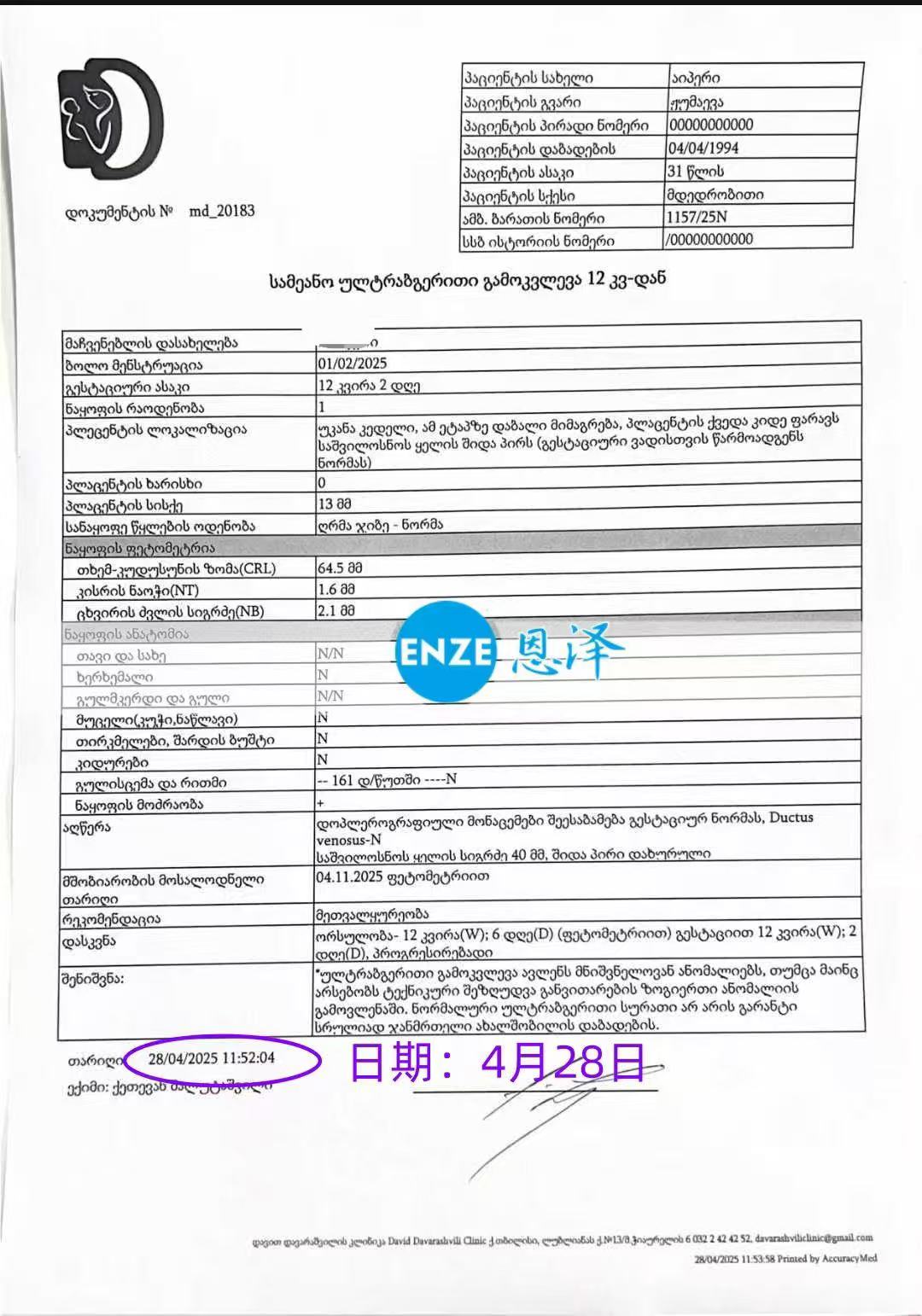 格鲁吉亚试管婴儿助孕爱心使者12周产检顺利通过