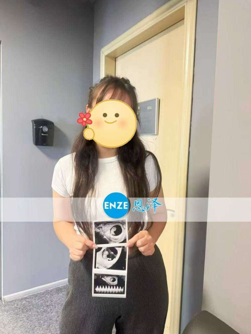 格鲁吉亚试管婴儿助孕爱心使者8周产检顺利通过