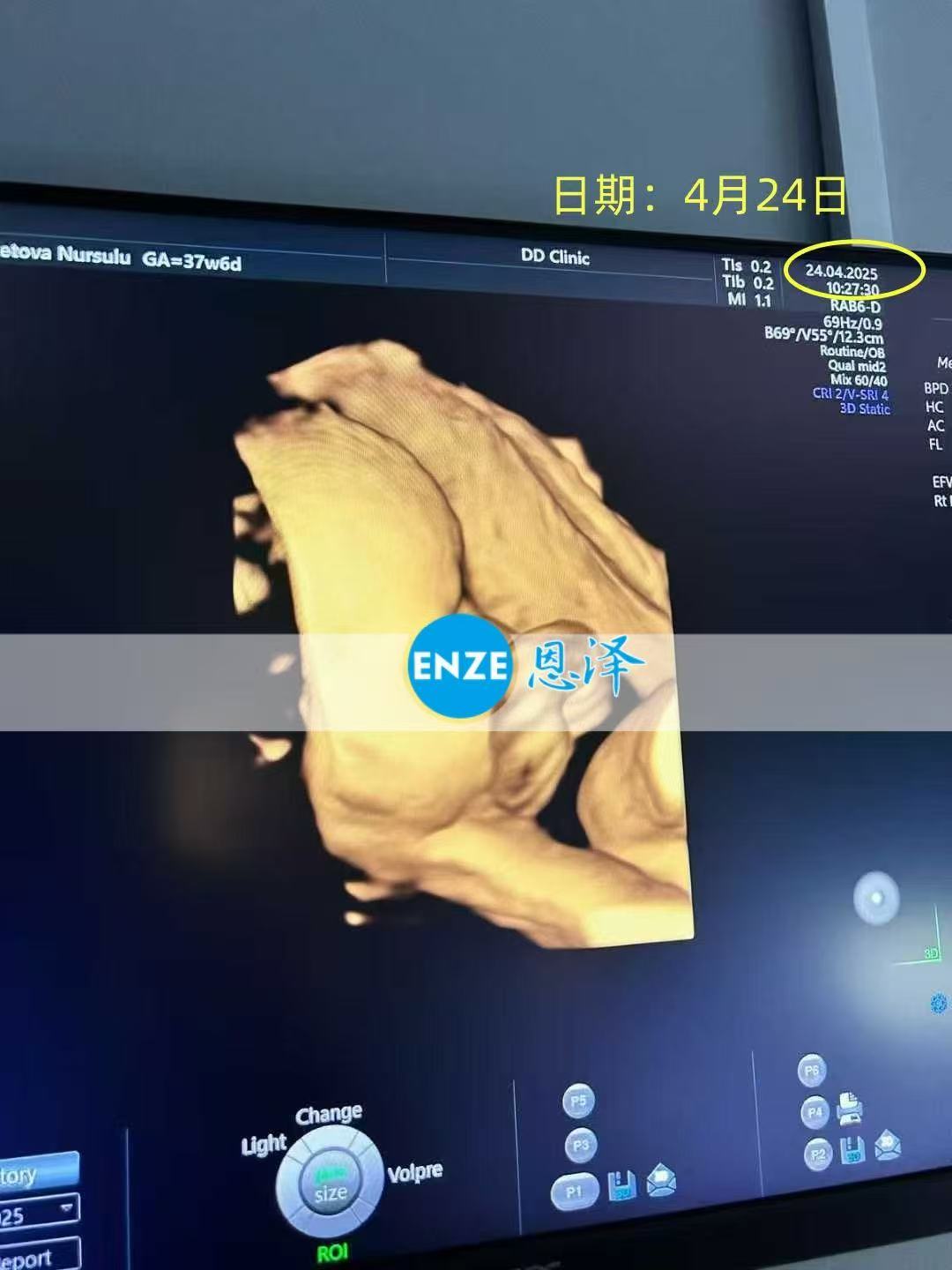 格鲁吉亚试管婴儿助孕爱心使者准备迎接宝贝诞生