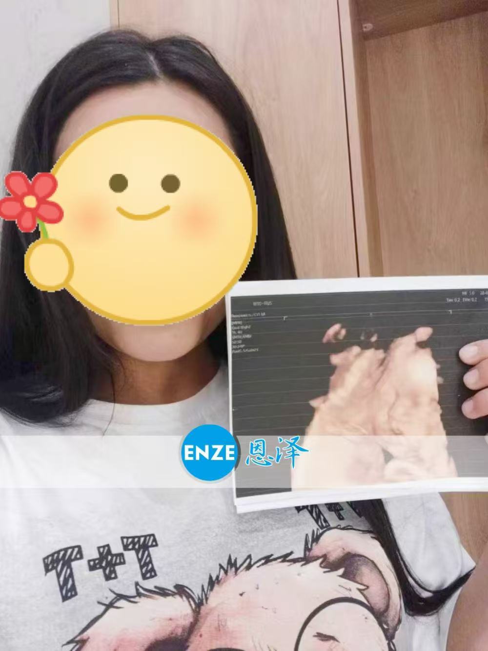 哈萨克斯坦试管婴儿助孕爱心使者成功通过29周产检
