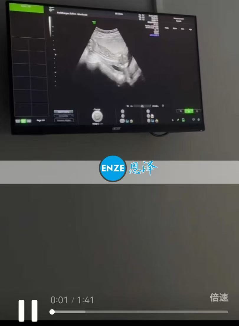 格鲁吉亚试管婴儿助孕爱心使者16周产检顺利过关
