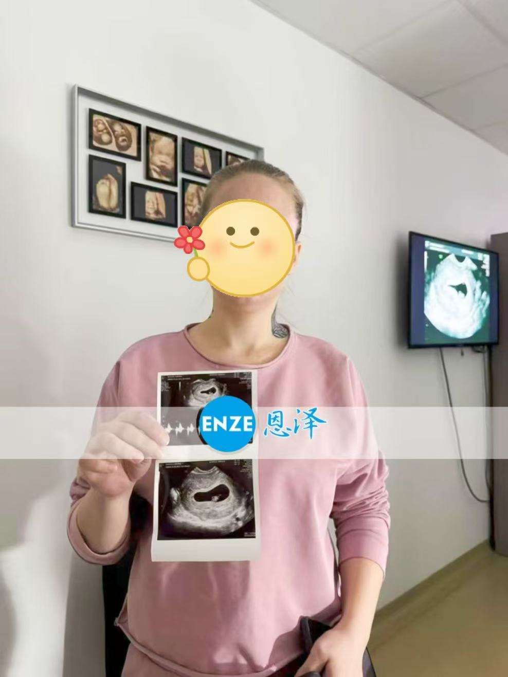 格鲁吉亚试管婴儿助孕爱心使者首次产检顺利通过