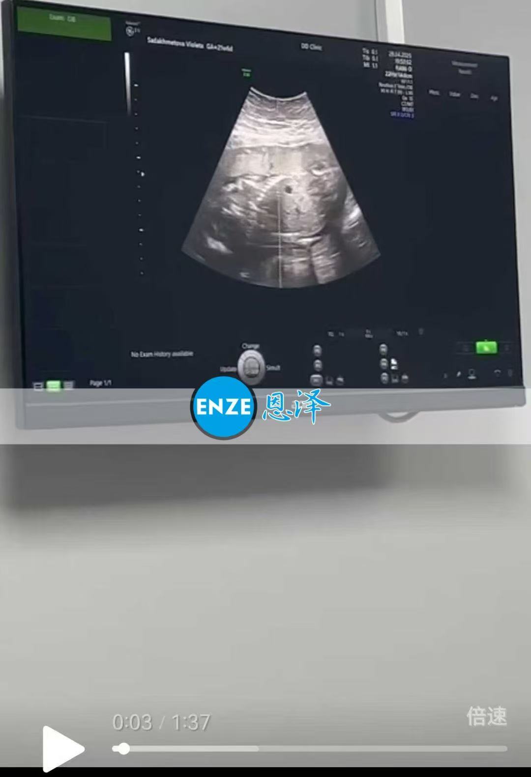 格鲁吉亚试管婴儿助孕爱心使者21周产检顺利通过