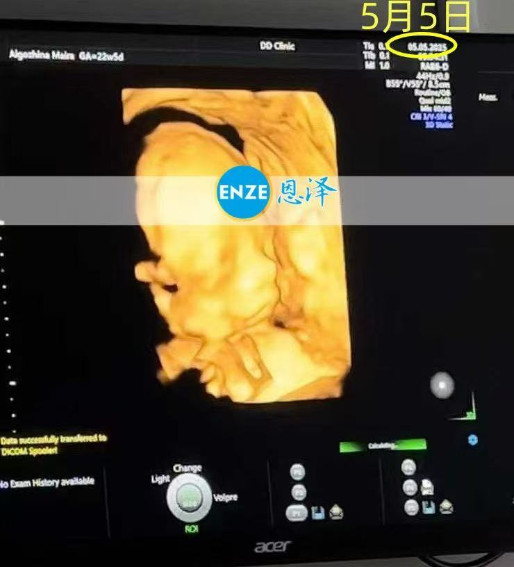 格鲁吉亚试管婴儿助孕爱心使者22周产检顺利通过