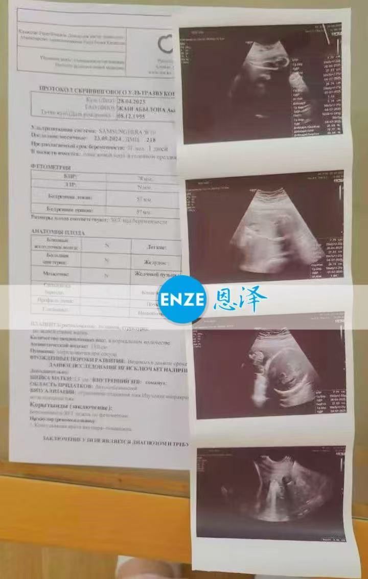 格鲁吉亚试管婴儿助孕爱心使者31周产检顺利通过