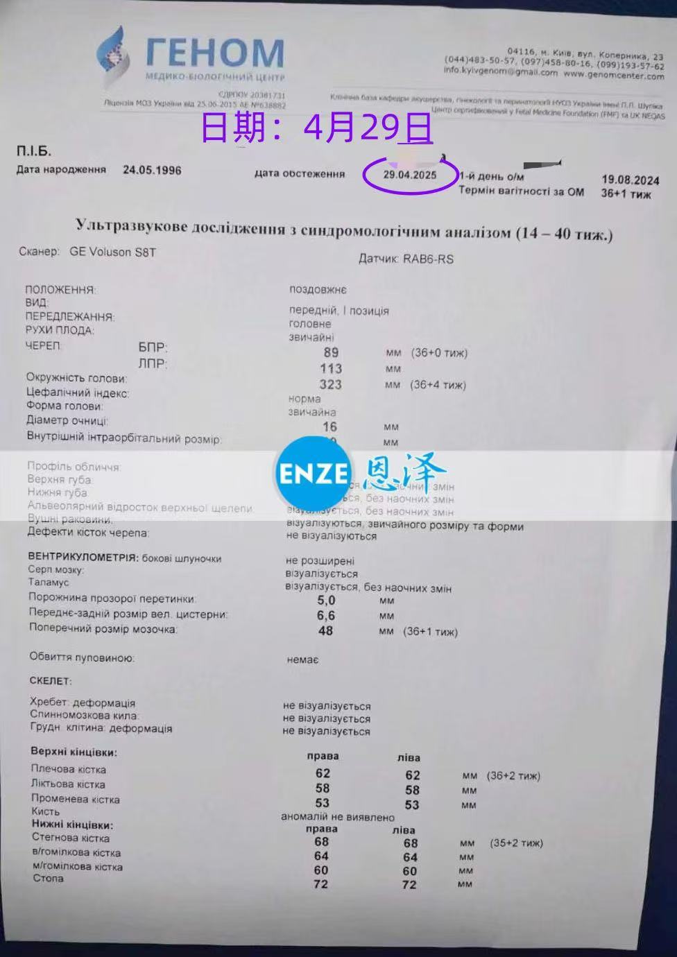 乌克兰试管婴儿助孕爱心使者产检顺利，静待宝贝降生