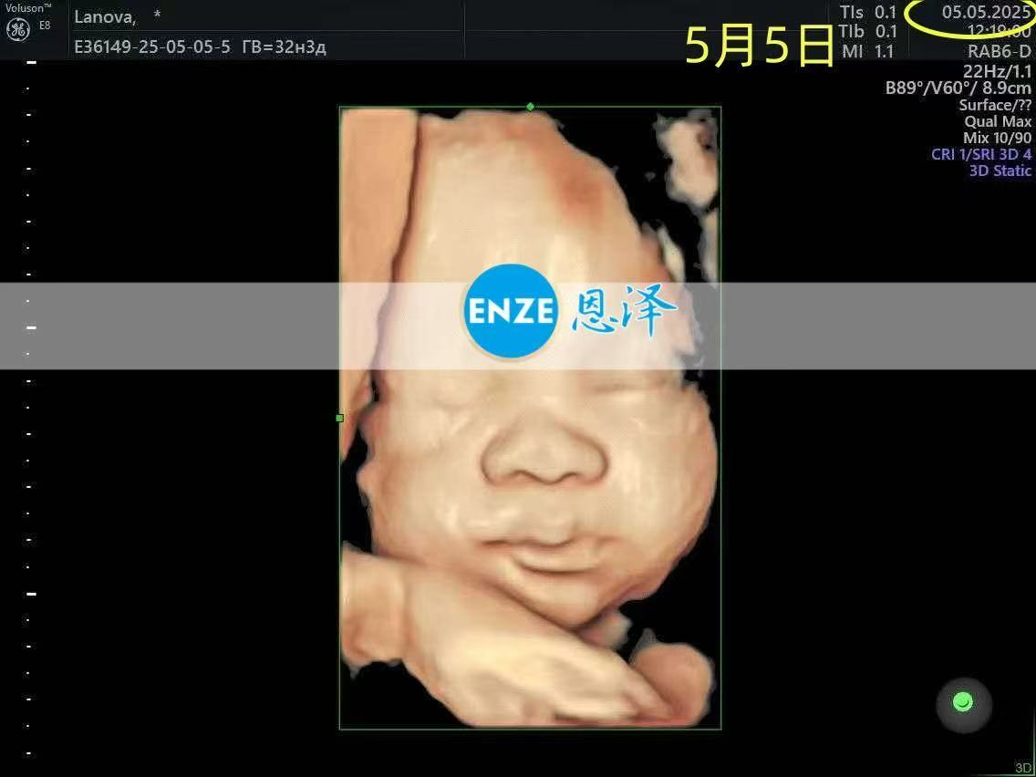 格鲁吉亚试管婴儿助孕爱心使者32周产检顺利通过