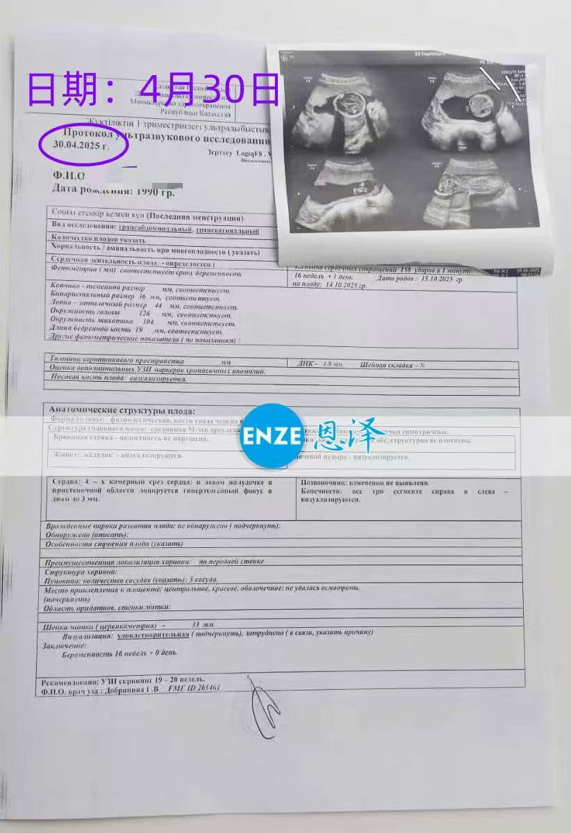 格鲁吉亚试管婴儿助孕爱心使者16周产检顺利过关