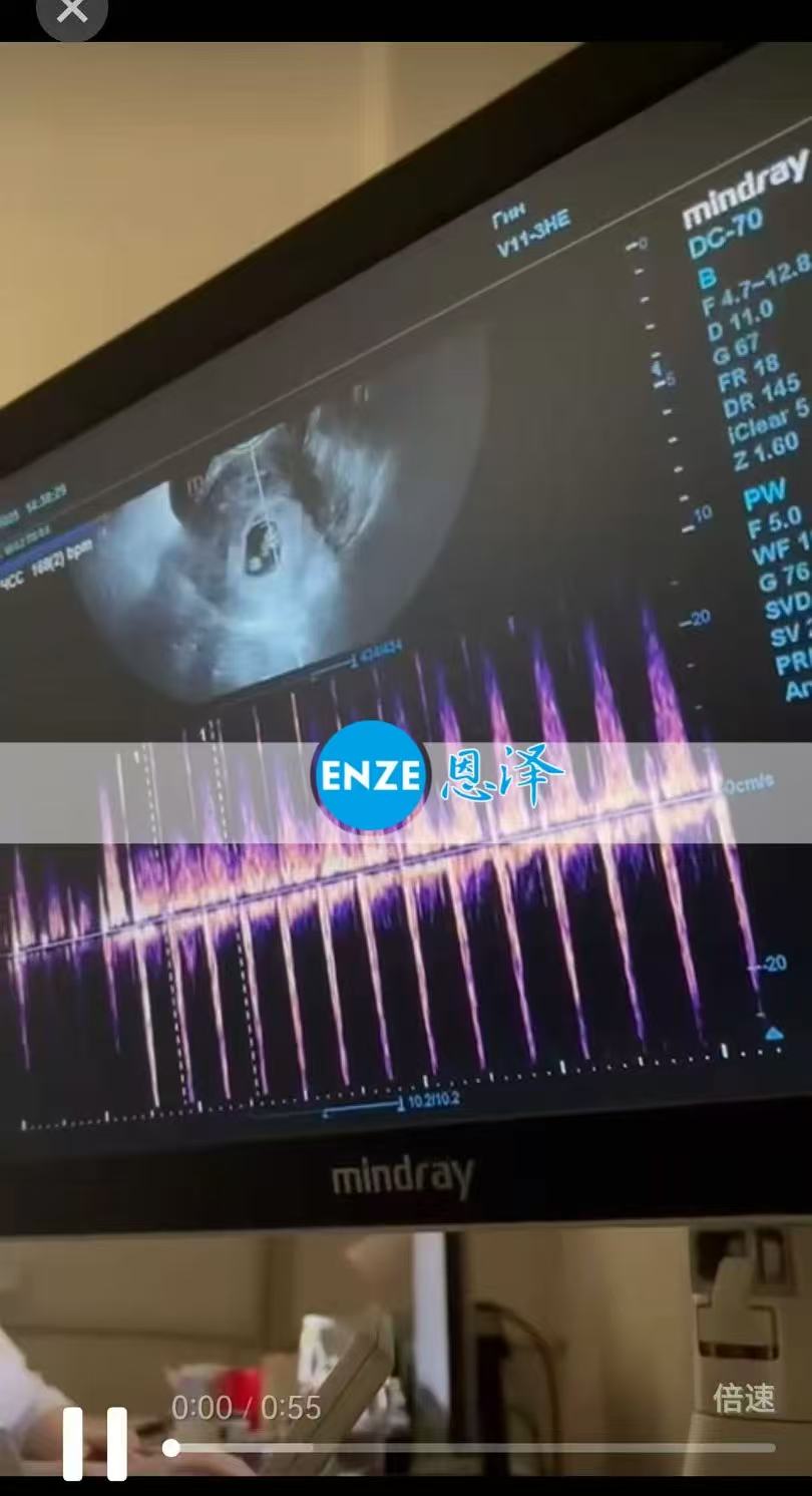 格鲁吉亚试管婴儿助孕爱心使者8周产检顺利过关