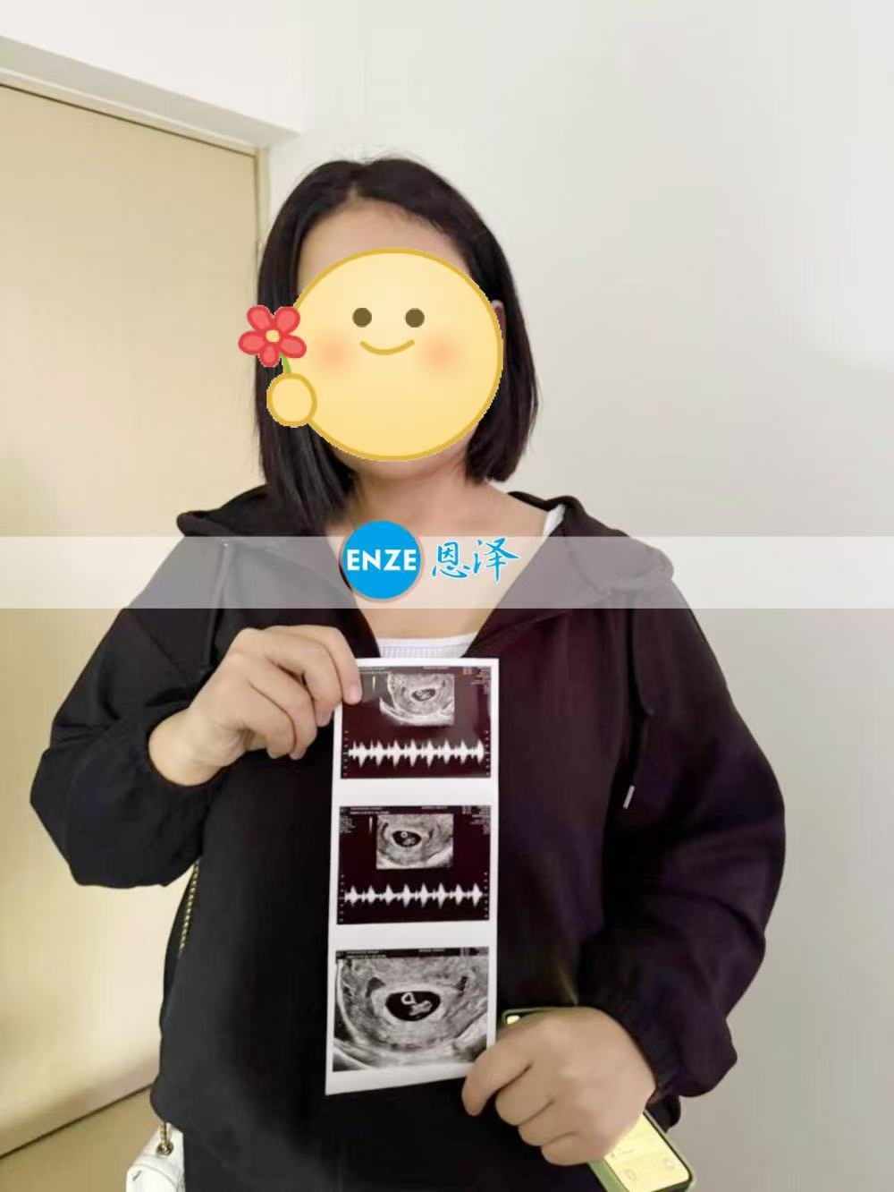 格鲁吉亚试管婴儿助孕爱心使者成功通过7周产检