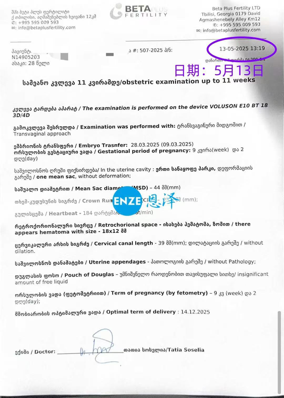 格鲁吉亚试管婴儿助孕爱心使者9周产检顺利过关