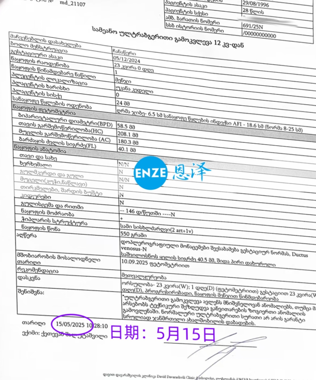 恩泽格鲁吉亚试管婴儿助孕爱心使者23周检查顺利通过
