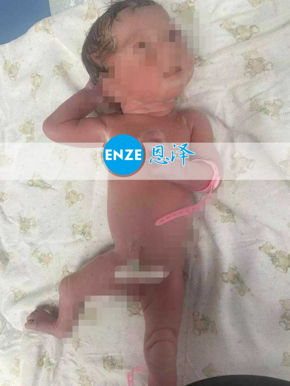 恩泽吉尔吉斯斯坦试管婴儿助孕宝宝顺利出生