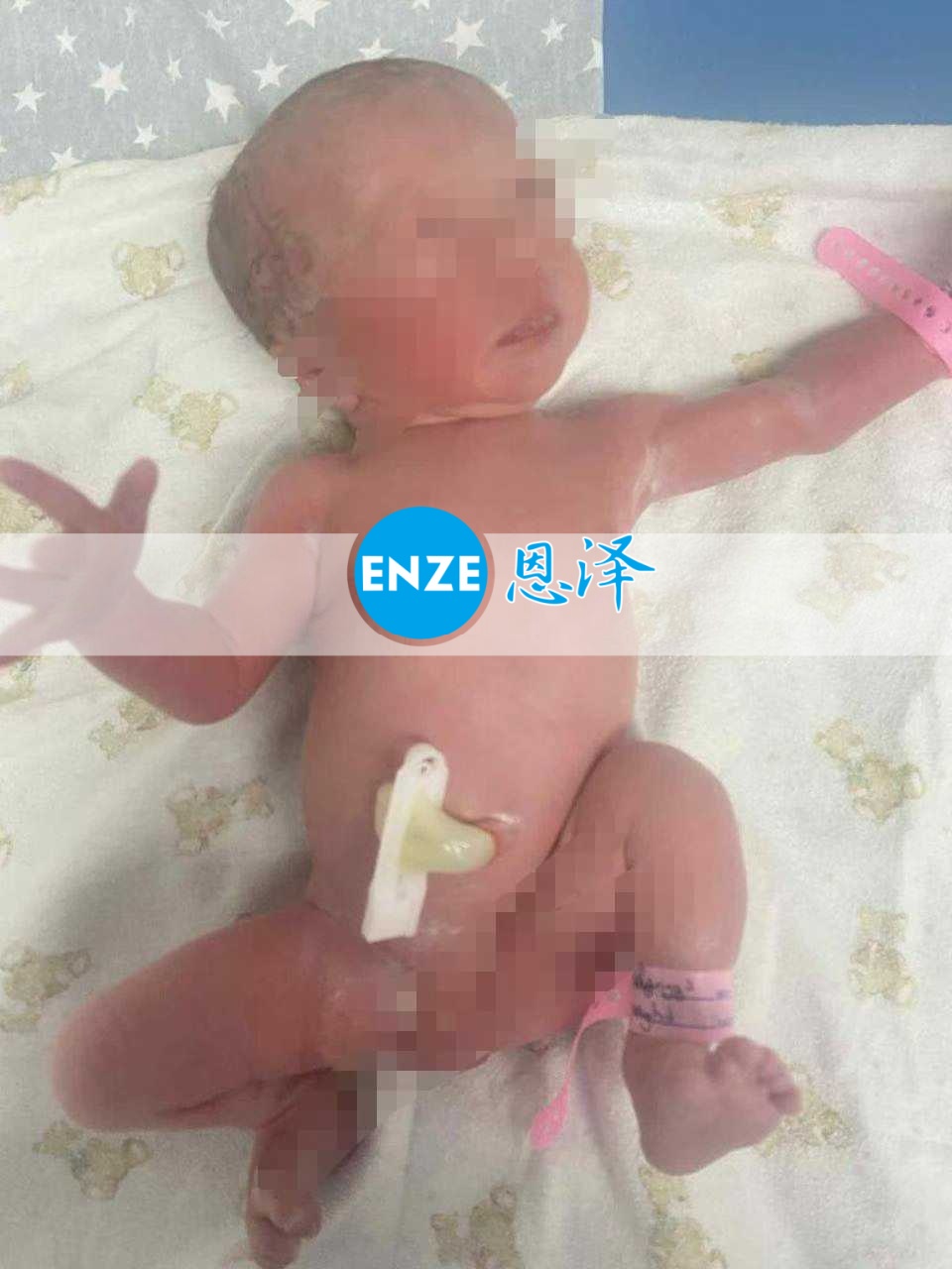 恩泽吉尔吉斯斯坦试管婴儿助孕宝宝顺利出生