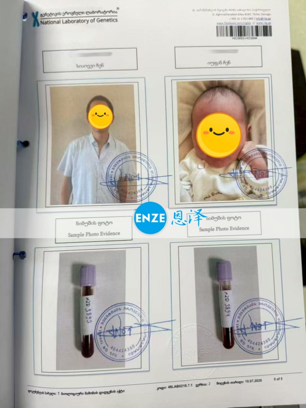 恩泽吉尔吉斯斯坦试管婴儿助孕亲子鉴定结果新鲜出炉