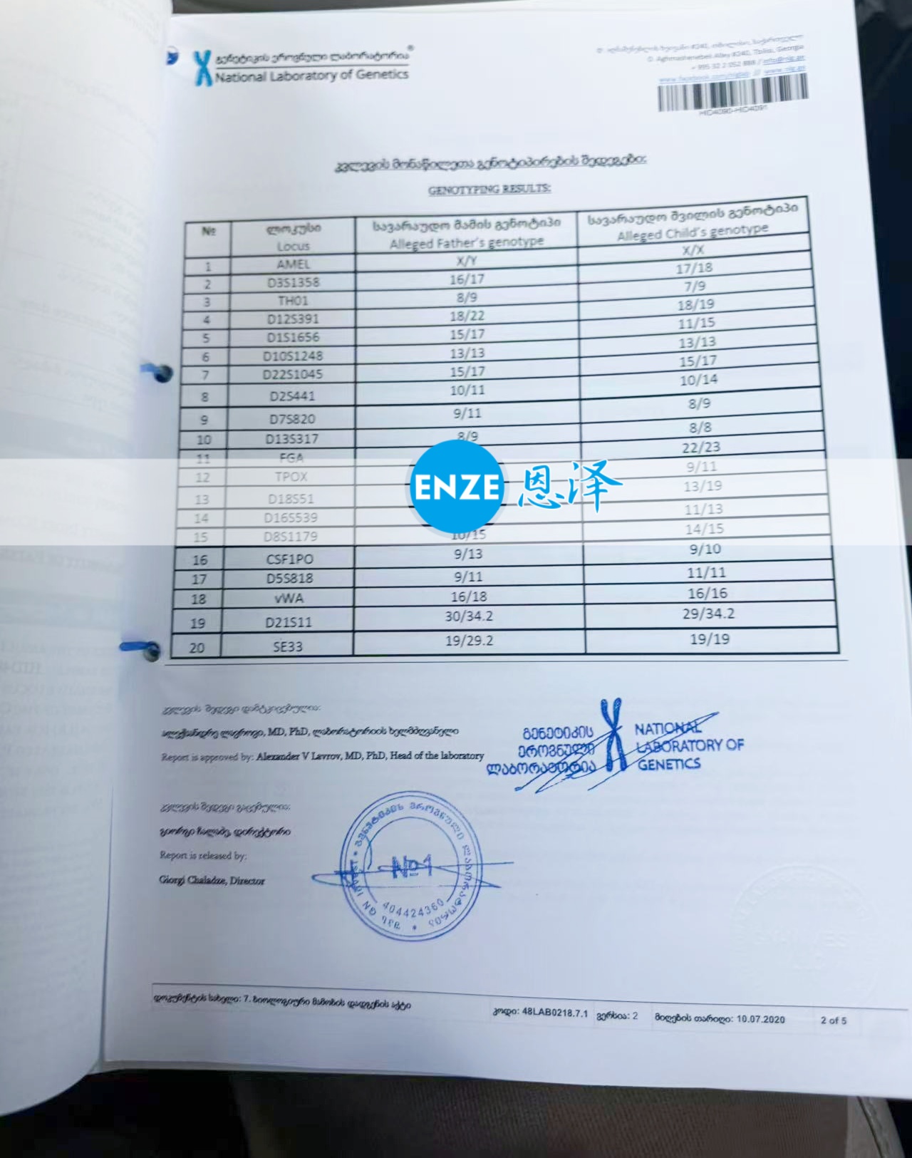 恩泽吉尔吉斯斯坦试管婴儿助孕亲子鉴定结果新鲜出炉